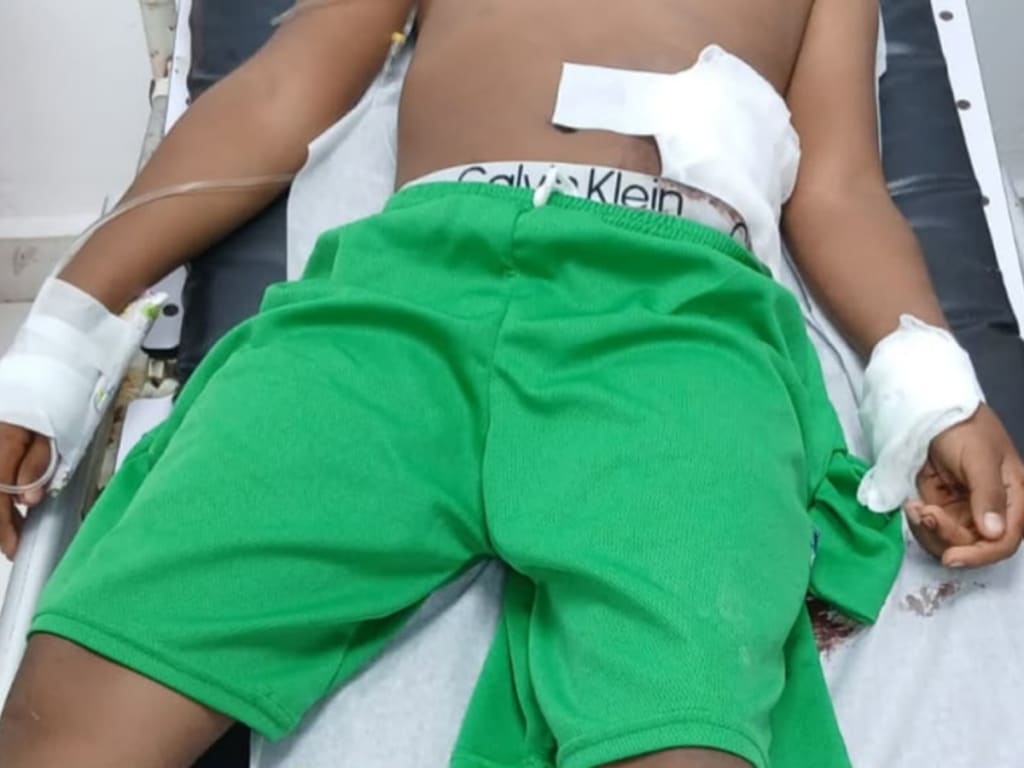Menor resulta herido de bala en el abdomen al manipular arma artesanal en Barahona